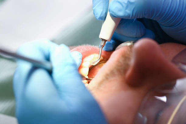 Best Emergency Treatment for Toothache in Lewisburg, WV